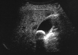 超音波検査・エコー検査とは